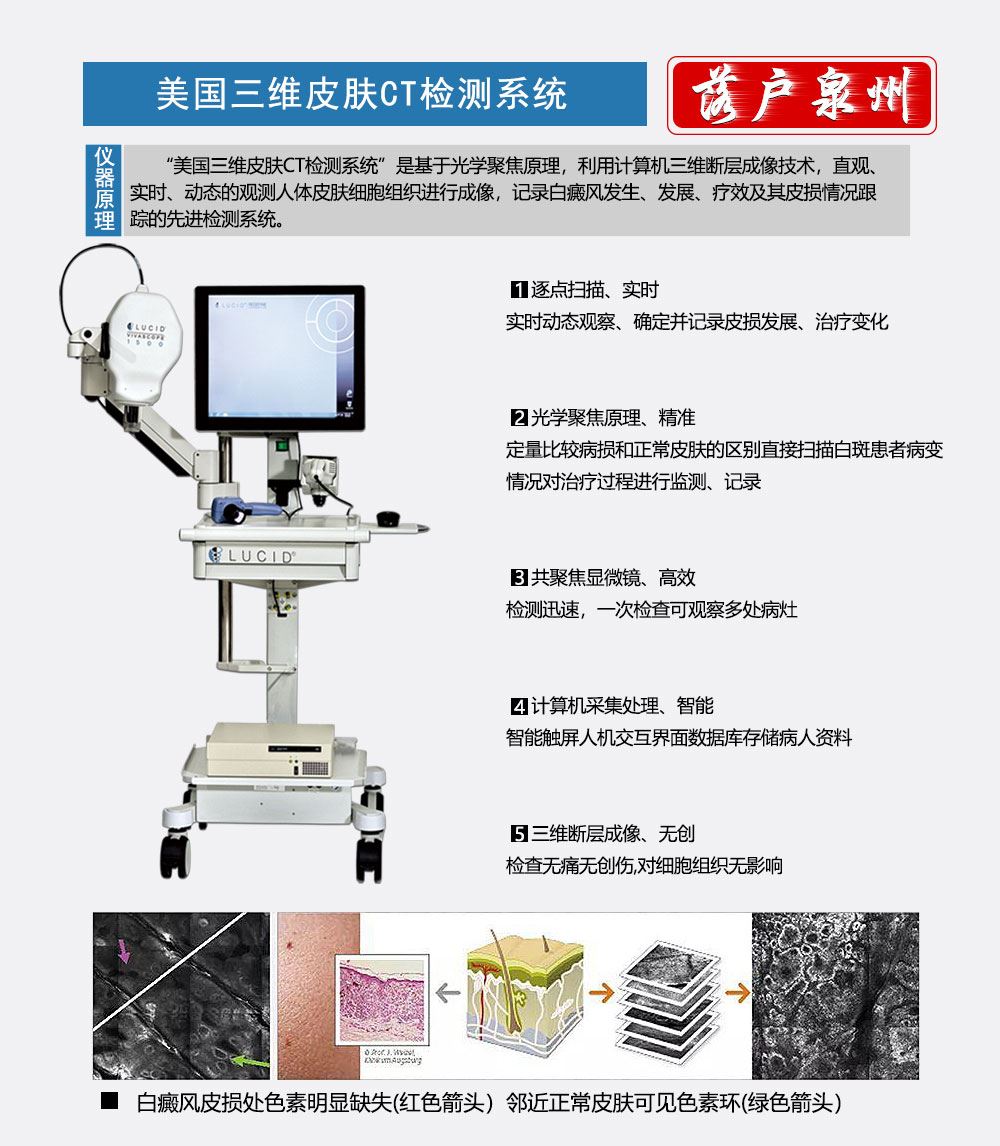 第一代美国三维皮肤CT