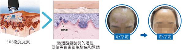 美国308激光工作原理