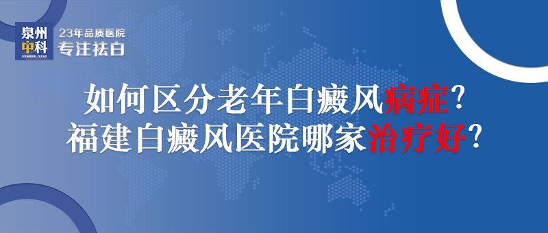 如何区分老年白癜风病症？泉州白癜风医院治疗哪家好？