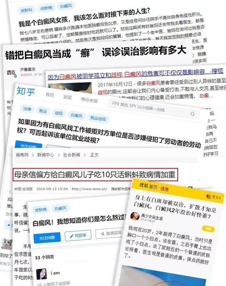 [七夕告白特辑]泉州白癜风患者面部白斑终于没了,爱情不请自来！