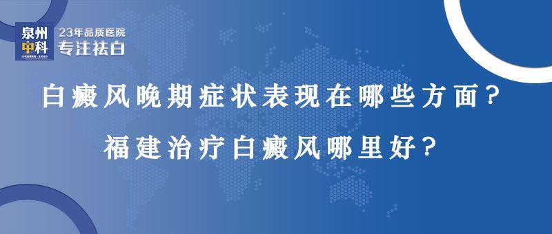 白癜风晚期症状表现在哪些方面？泉州专业白癜风医院地址？