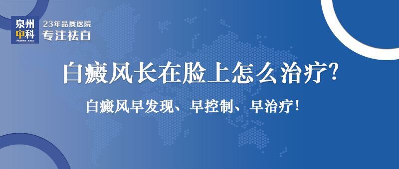 白癜风长在脸上怎么治疗？泉州泉州哪里治疗白癜风好？