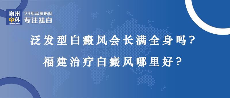 【福建专业白癜风医院】泛发型白癜风会长满全身吗? 【福建专业白癜风医院】泛发型白癜风会长满全身吗?