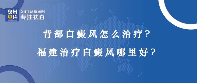 【福建哪里看白癜风好】背部白癜风怎么治疗？