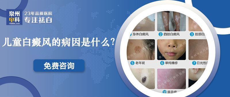 泉州儿童患节段型白癜风的原因是什么？