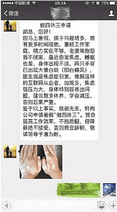 “做四休三”奇葩辞职背后的焦虑与白癜风 “做四休三”奇葩辞职背后的焦虑与白癜风