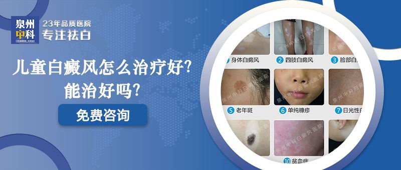 儿童患白癜风需要注意什么? 儿童患白癜风需要注意什么?
