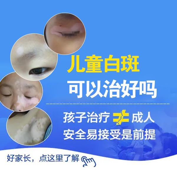 泉州好的白癜风医院官网,儿童白癜风复发的因素 泉州好的白癜风医院官网,儿童白癜风复发的因素