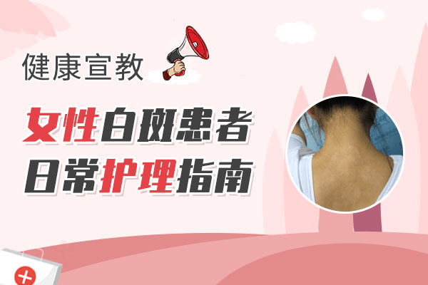 女性腰部白癜风要怎么治疗好? 女性腰部白癜风要怎么治疗好?