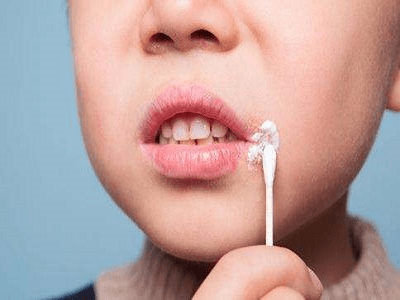 青少年头上出现了白点是白癜风吗? 青少年头上出现了白点是白癜风吗?