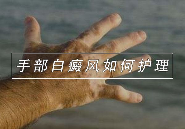 手部白癜风如何护理? 手部白癜风如何护理?