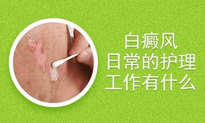 白癜风患者在日常中要注意哪些护理? 白癜风患者在日常中要注意哪些护理?