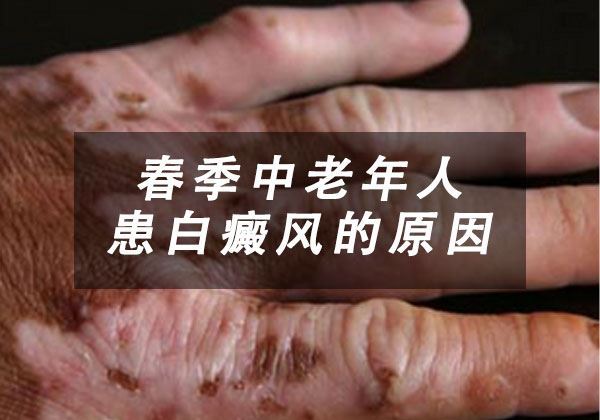 春季中老年人患白癜风的原因是什么 春季中老年人患白癜风的原因是什么