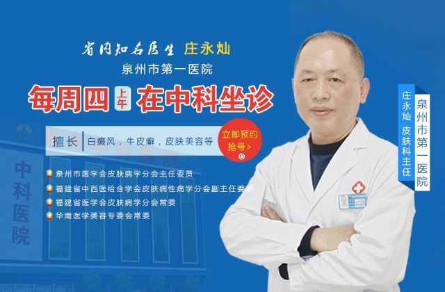 泉州中科白癜风医院坐诊专家庄永灿