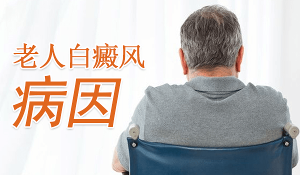 泉州老人患白癜风的病因有什么?