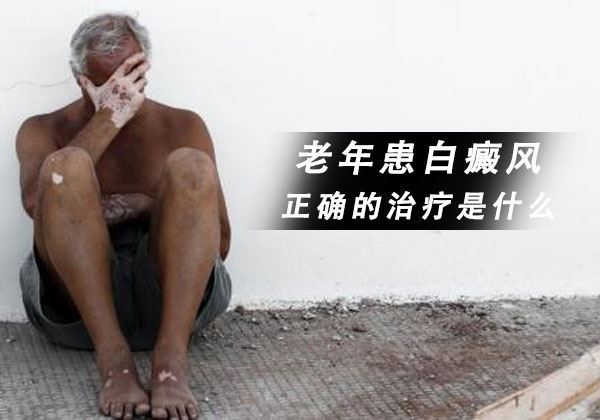 老年人患白癜风正确的治疗是什么? 老年人患白癜风正确的治疗是什么?