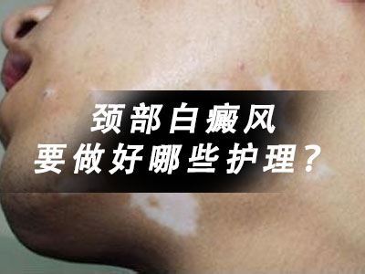 泉州女性颈部白癜风要做好哪些护理呢?