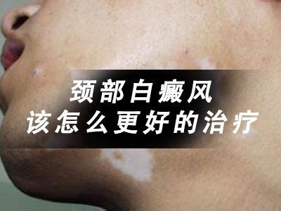该怎么治疗好脖子上的白癜风? 该怎么治疗好脖子上的白癜风?