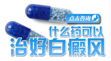 如何合理使用药物治疗白癜风？