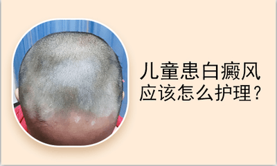 儿童局限型白癜风在日常护理中应该做些什么? 儿童局限型白癜风在日常护理中应该做些什么?