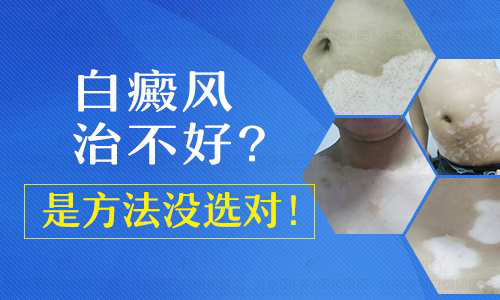 患了白癜风如何治疗才好呢? 患了白癜风如何治疗才好呢?