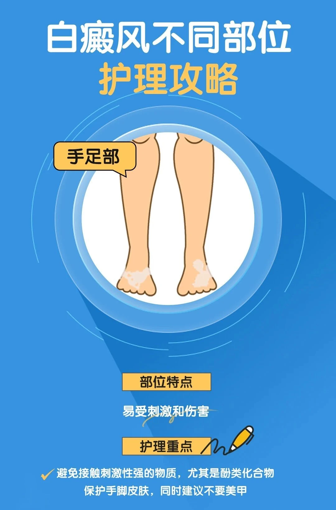 不同部位白斑护理重点大不同，福建泉州中科白癜风医院为您提供分部位精准护理指南。
