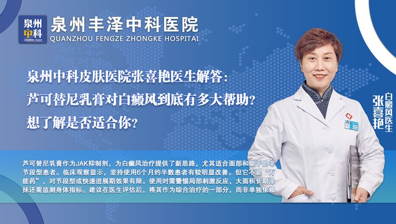 福建泉州中科皮肤医院张喜艳医生解答：芦可替尼乳膏对白癜风到底有多大帮助？想了解是否适合你，点击咨询